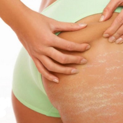 How to lighten inner thighs – Forgotten Skincare